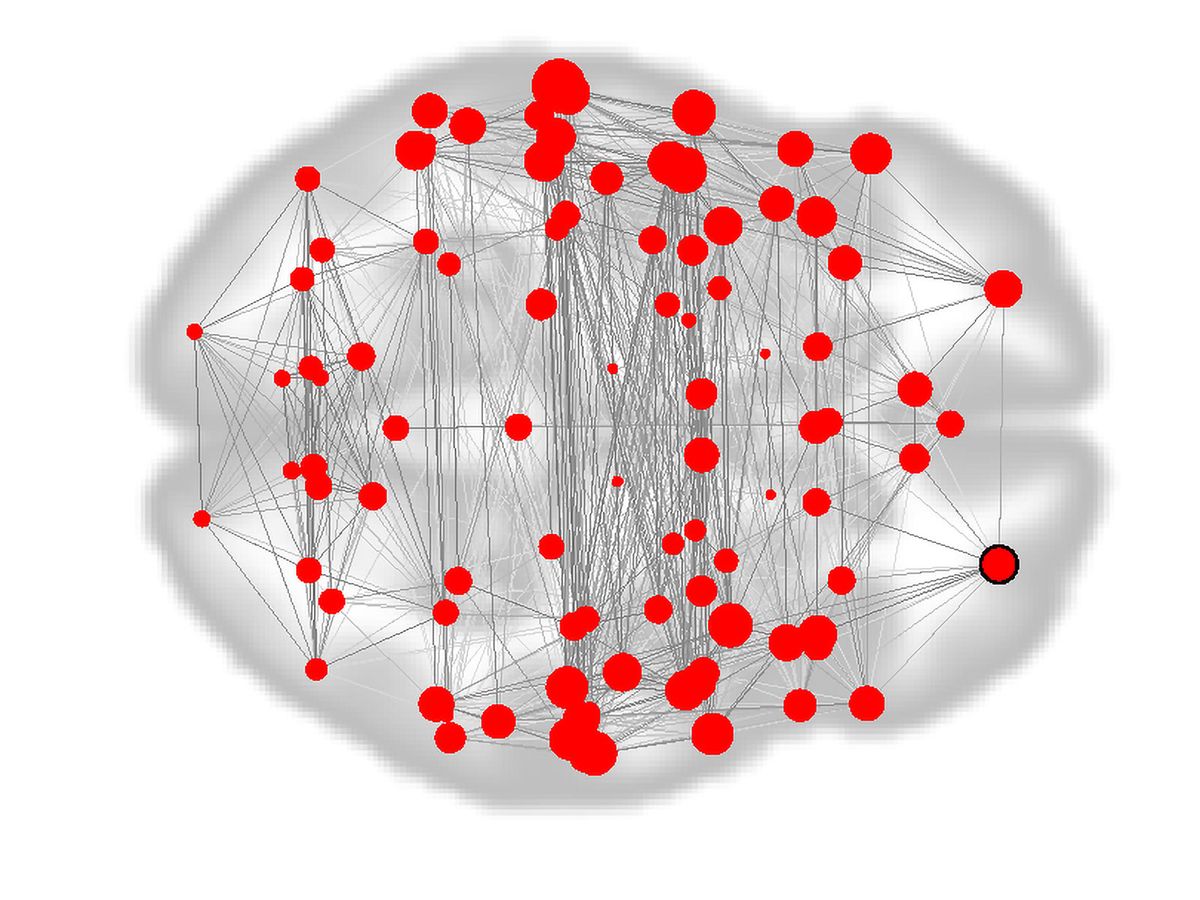 Can a ‘Fingerprint’ of Your Brain Help Predict Disorders? post thumbnail image