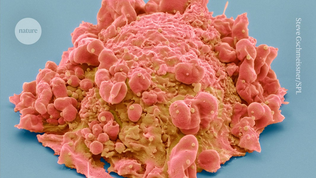 Ultra-precise 3D maps of cancer cells unlock secrets of how tumours grow post thumbnail image