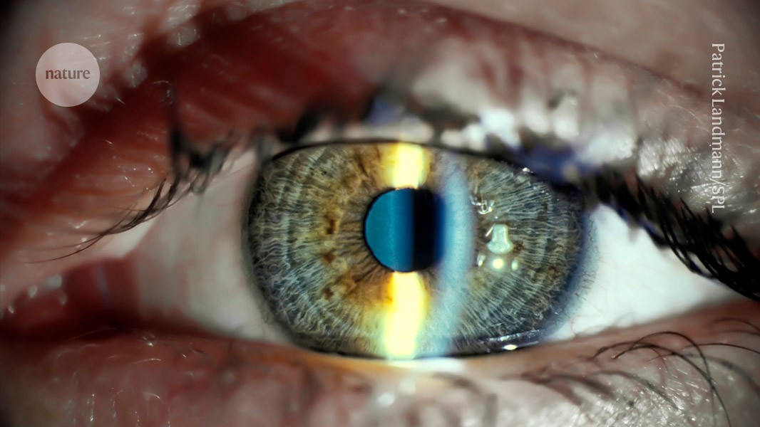 World-first stem-cell treatment restores vision in people post thumbnail image