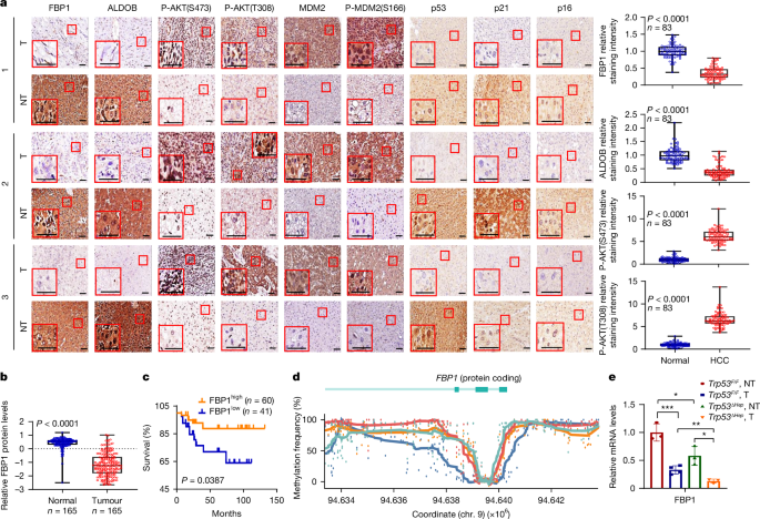 FBP1 controls liver cancer evolution from senescent MASH hepatocytes post thumbnail image