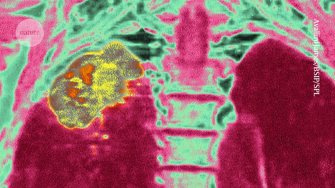 How to trick the immune system into attacking tumours post thumbnail image