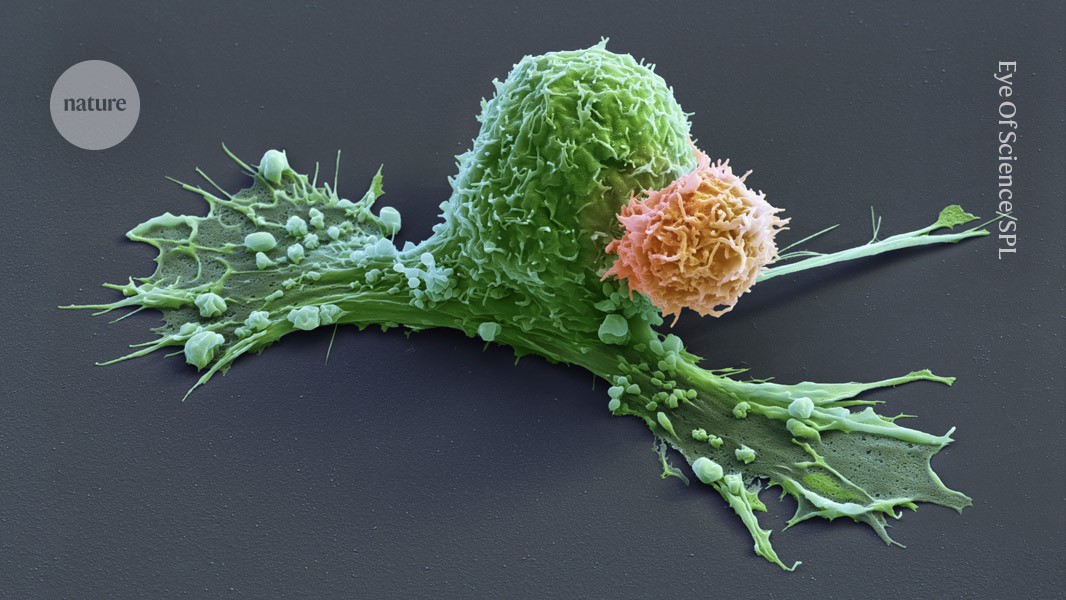 Woman in cancer remission for record 19 years after CAR-T immune treatment post thumbnail image