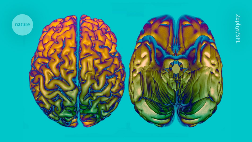 How fast your brain ages is affected by these 64 genes post thumbnail image